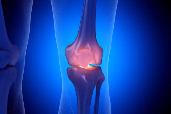 graphic of knee x-ray with red bones